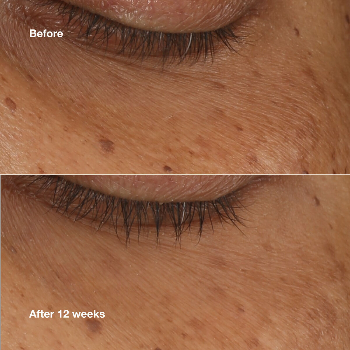Illuminating Serum Clinique ALL ABOUT EYES 10 ml til kvinder serumflaske