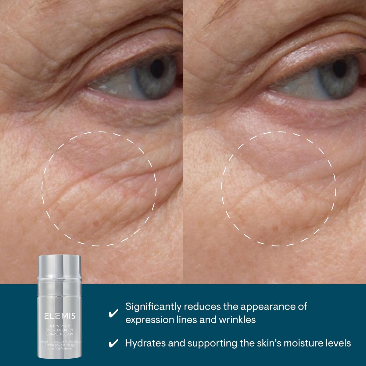 V1H1B18A1900DB5AB7DF90A7F4D2A08303ERP1