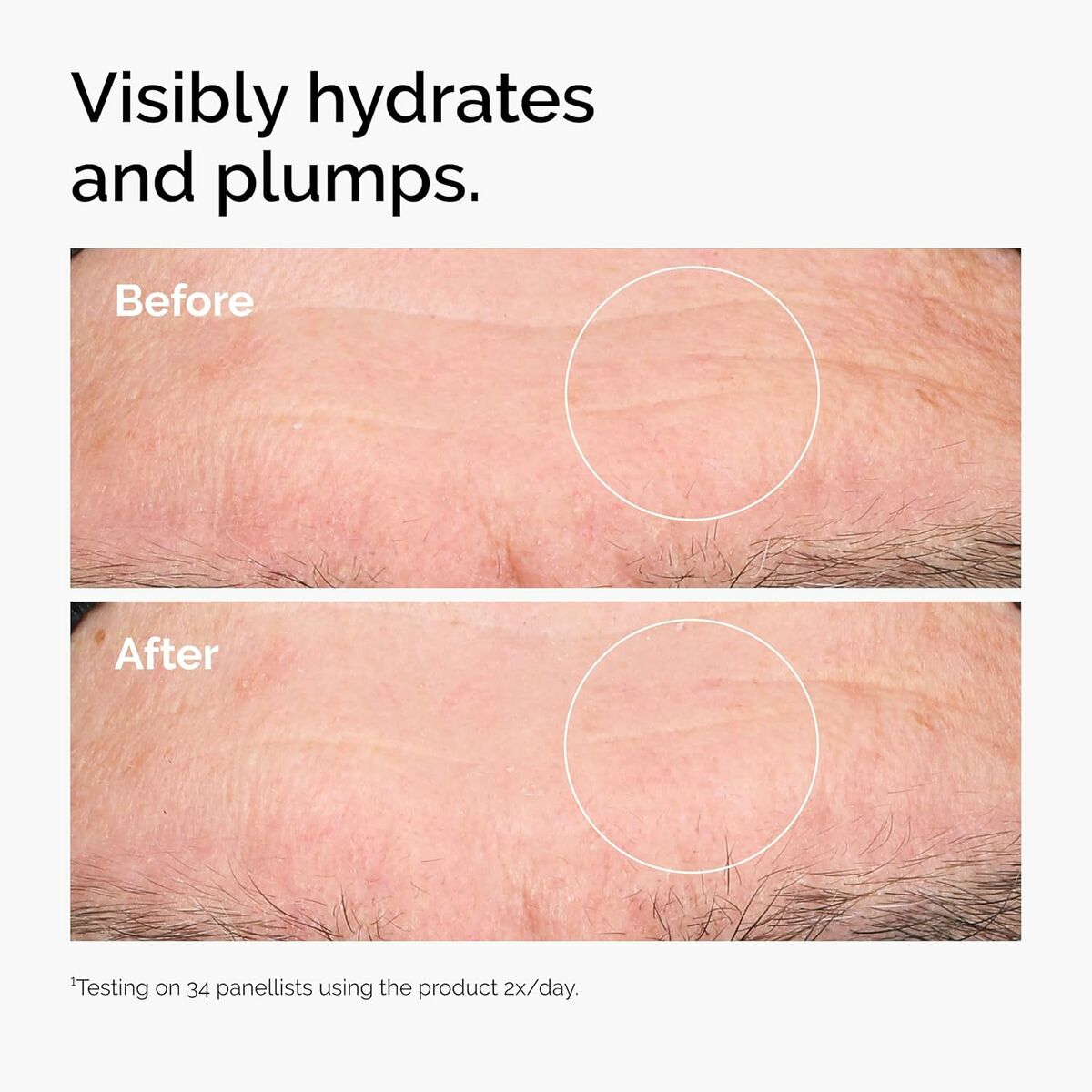 Ansigtsserum Den almindelige HYALURONSYRE 2% + B5 30 ml serumflaske