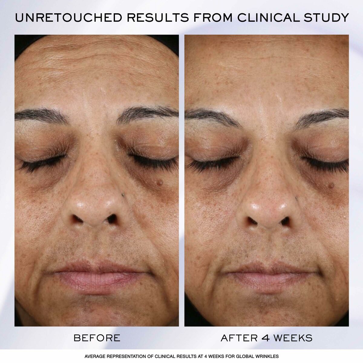 Dagcreme Lancôme Rénérgie Lift Ultra 50 ml til kvinder hudplejeemballage