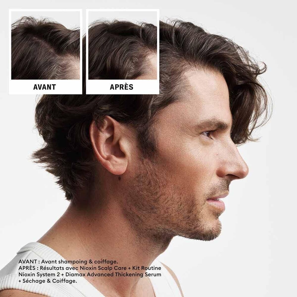 Shampoo og balsam Nioxin shampooflaske