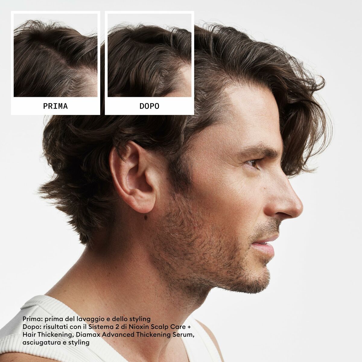 Hårdressingssæt Nioxin 3D CARE SYSTEM produktemballage