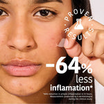 Ansigtscreme Iroha Hudpleje emballage til ACNE TILBAGET HUD