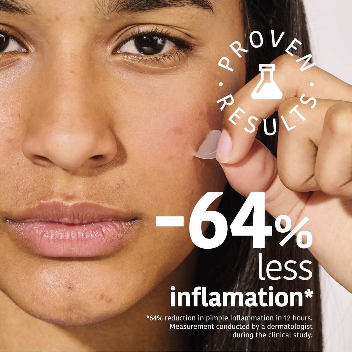 Ansigtscreme Iroha Hudpleje emballage til ACNE TILBAGET HUD