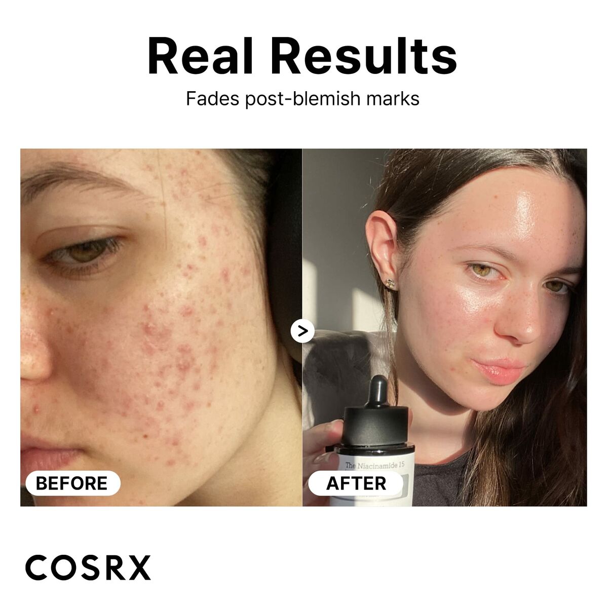 Ansigtscreme Cosrx THE NIACINAMIDE 20 ml hudplejeemballage til kvinder